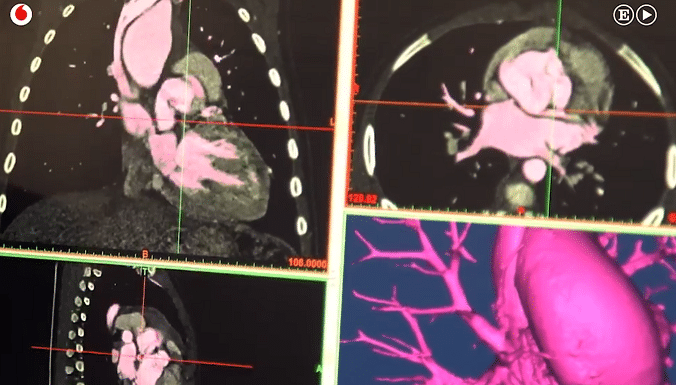Órganos 3D y realidad virtual