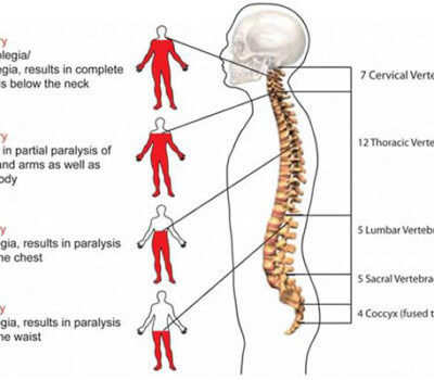 La impresión 3D que podría restaurar la médula ósea