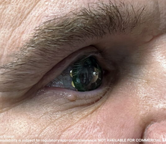 Mojo Vision suspende producción de sus lentillas AR mojo vision mojo lens 2023